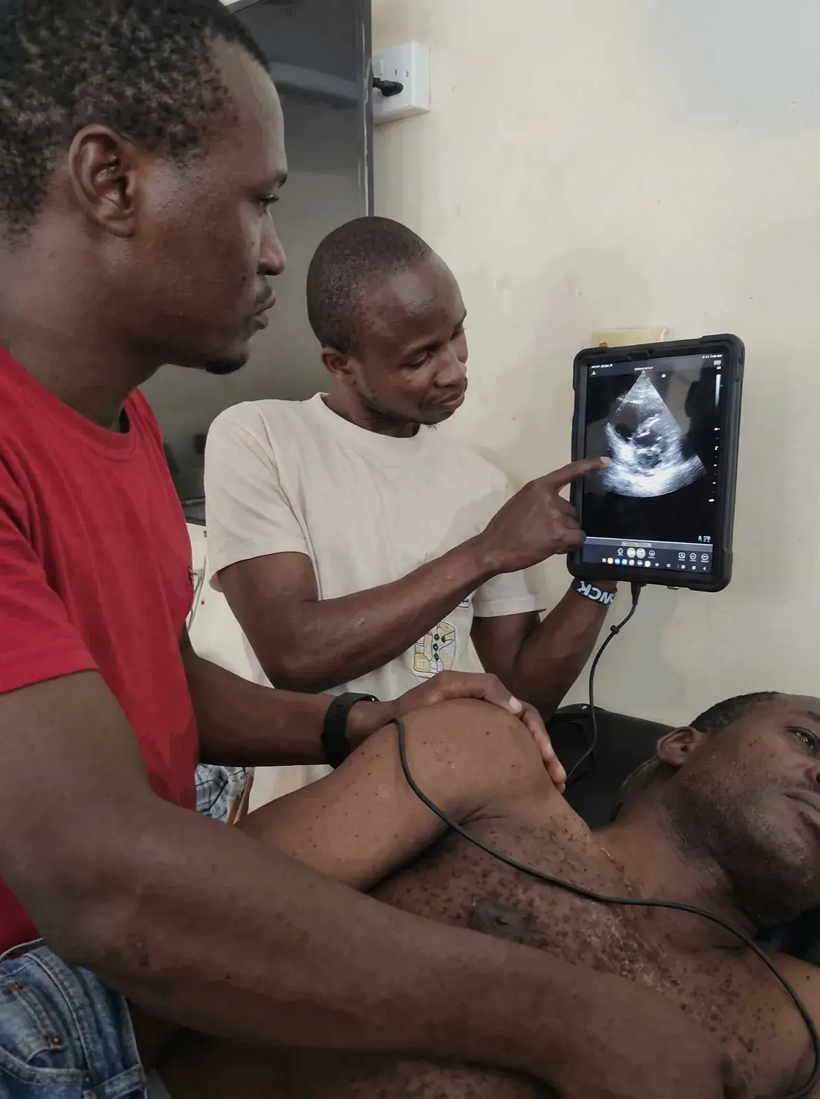 Cardiac ultrasound training at point of care in Togo